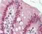 AKAP8 / AKAP95 Antibody (aa331-380)